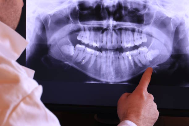 Best Chipped Tooth Repair Near Me  in Brecksville, OH