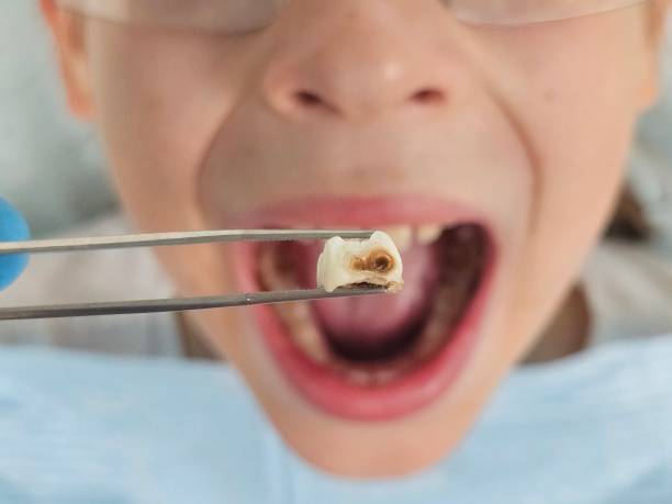 Best Cracked Tooth Emergency Dentist  in Brecksville, OH