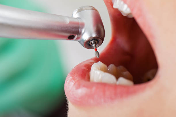 Best Tooth Infection Emergency Dentist  in Brecksville, OH